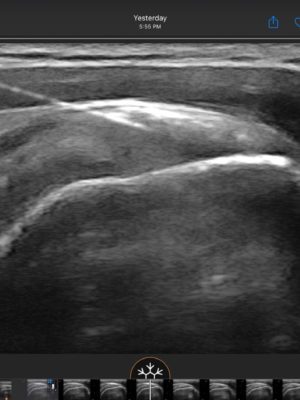 MSK Ultrasound Image