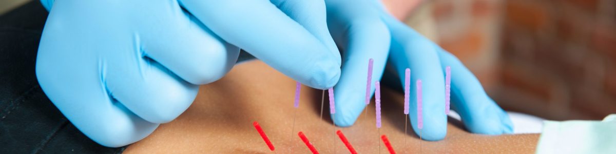 Neurologic Dry Needling for Cranio-Cervical Pain & Dysfunction (Home Study)